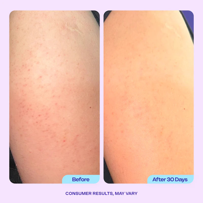 Refine & Renew Body Scrub